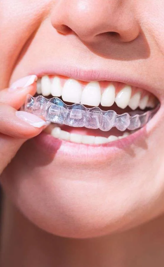 Straighten Up for the New School Year: Invisalign for Teens in Glendale